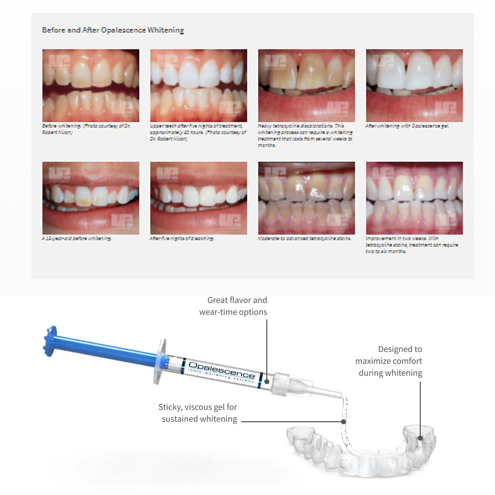 Opalescencia blanqueadora 20%  - Teeth Whitening Doctor reseña y precio