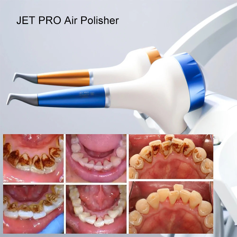 VV Dental Air Polishing Prophy - Teeth Whitening Usa reseña y precio