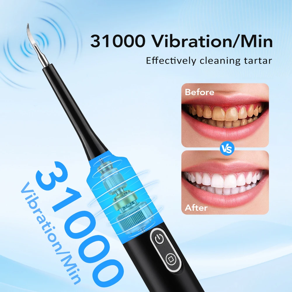 Limpiador Dental Eléctrico con - Teeth Whitening Mouthwash reseña y precio